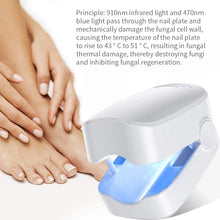 Nail Fungus Treatment LED Laser Device